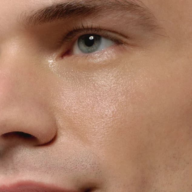 UNDER-EYE APPEARANCE After